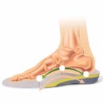 Unisex Gel Insoles For Flat Feet 10